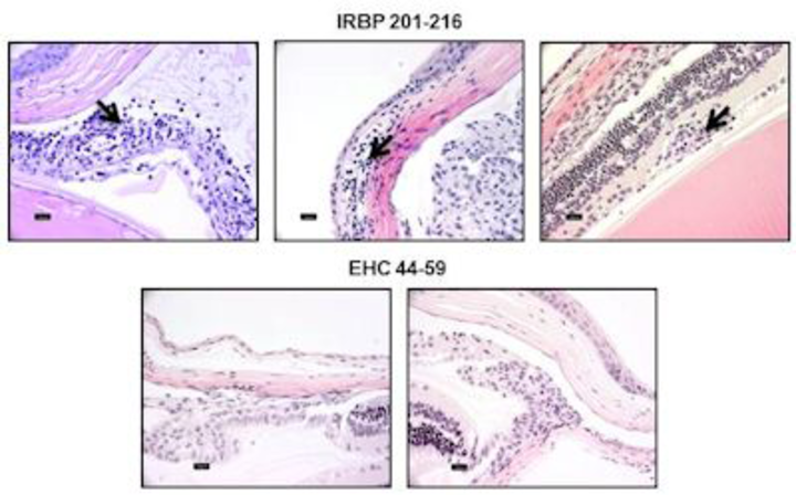 IRBP and EHC